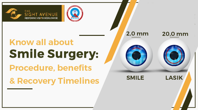 ReLEx SMILE (Small incision lenticule extraction)