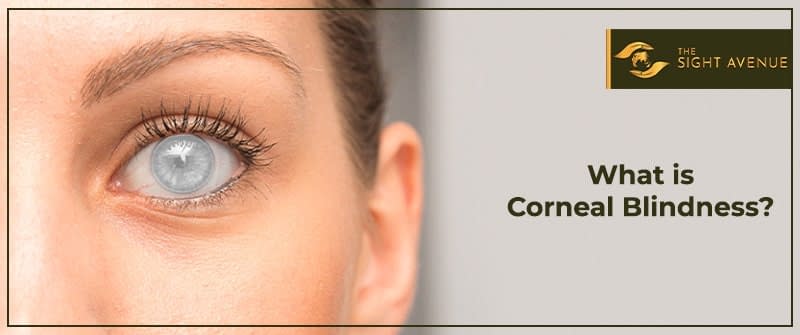 What One Should Know About Corneal Blindness