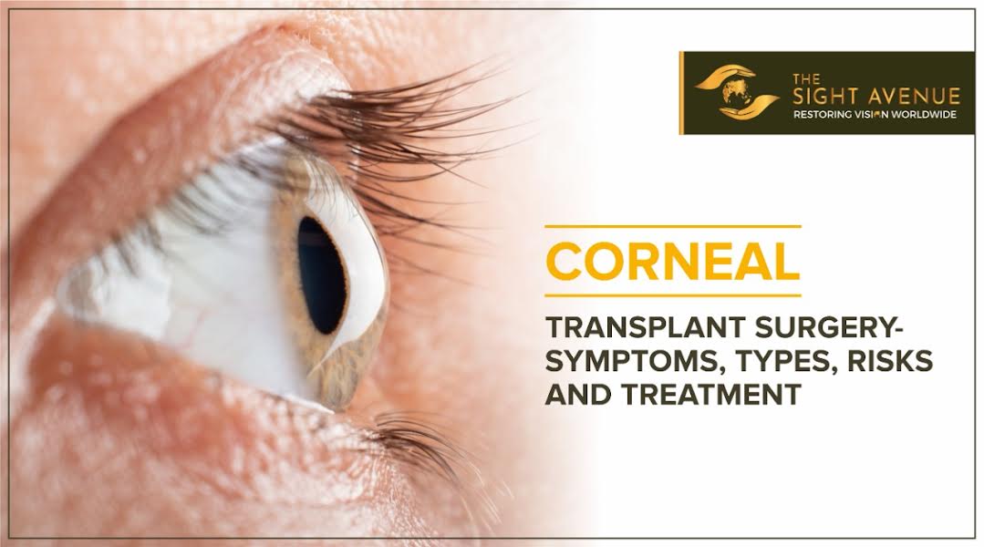 Corneal Transplant Surgery- Symptoms, Types, Risks and Treatment 