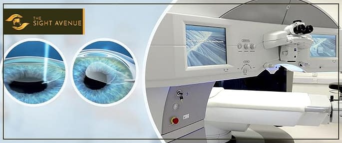 Which Suits You Best SMILE vs LASIK